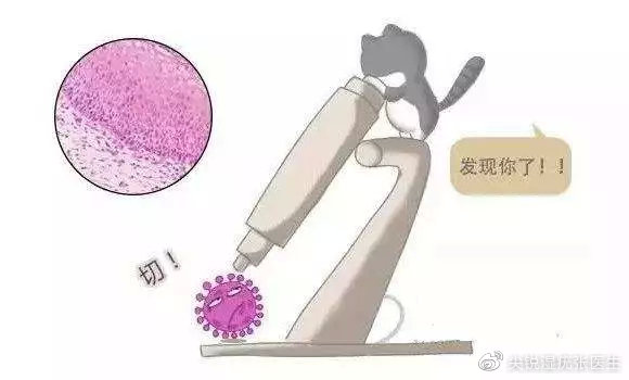 尖锐一个月能排除吗？——对尖锐湿疣的深入解析